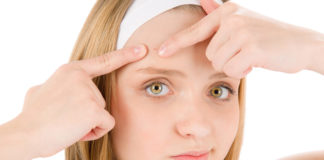 Natural Remedies for Acne – Home Remedies for Acne which Always Work Natural Remedies for Acne - Home Remedies for Acne which Always Work