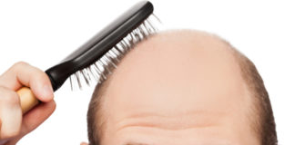 Home Remedies to Cure Baldness Effectively – Hair Loss Home Remedies to Cure Baldness Effectively - Hair Loss