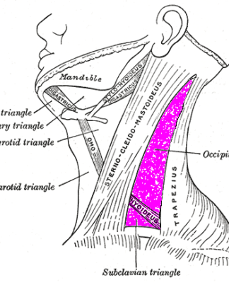 Cystic Hygroma